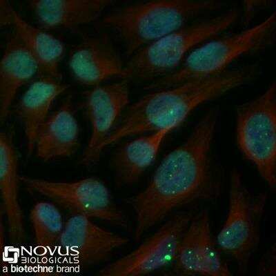 A431 cells were fixed for 10 minutes using 10% formalin and then permeabilized for 5 minutes using 1X PBS + 0.5% Triton-X100. The cells were incubated with 53BP1 Antibody at 2 ug/mL overnight at 4C and detected with an anti-rabbit Dylight 488 (Green) at a 1:500 dilution. Alpha tubulin (DM1A) NB100-690 was used as a co-stain at a 1:1000 dilution and detected with an anti-mouse Dylight 550 (Red) at a 1:500 dilution. Nuclei were counterstained with DAPI (Blue). Cells were imaged using a 40X objective.